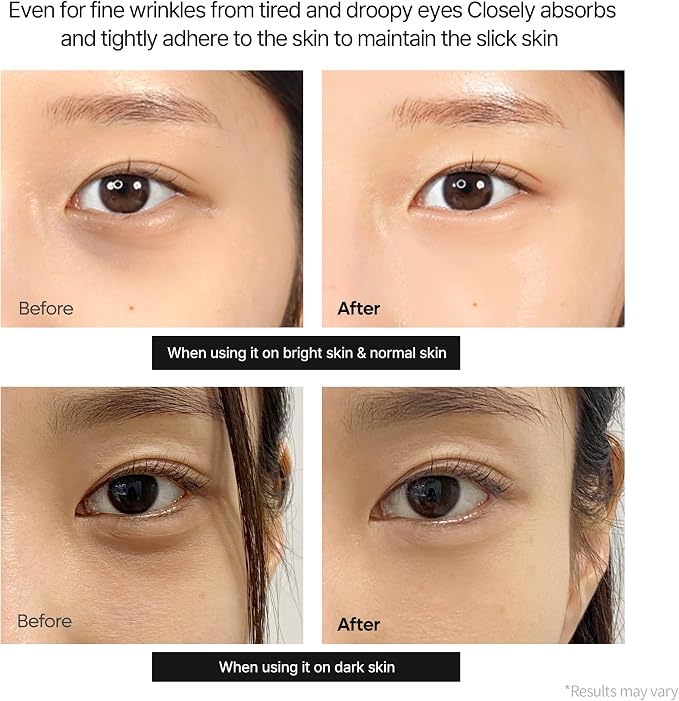 Brand before-and-after eye area photos shown on two different skin tones