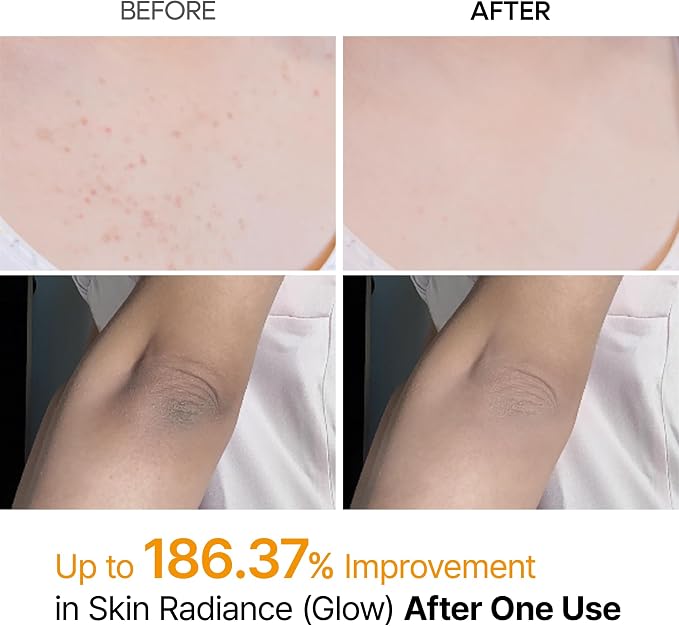 Brand before-and-after body skin close-ups with a skin radiance test percentage