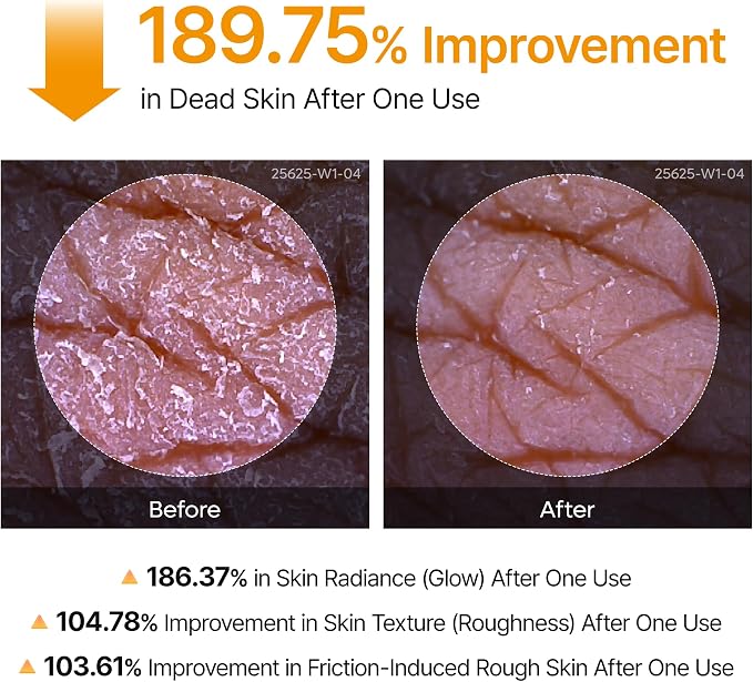 Brand microscope before-and-after skin images with exfoliation test percentages