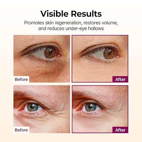 Brand before-and-after comparison photos of the under-eye area