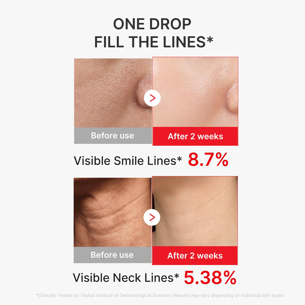 Brand before-and-after close-ups of smile lines and neck lines with test percentages